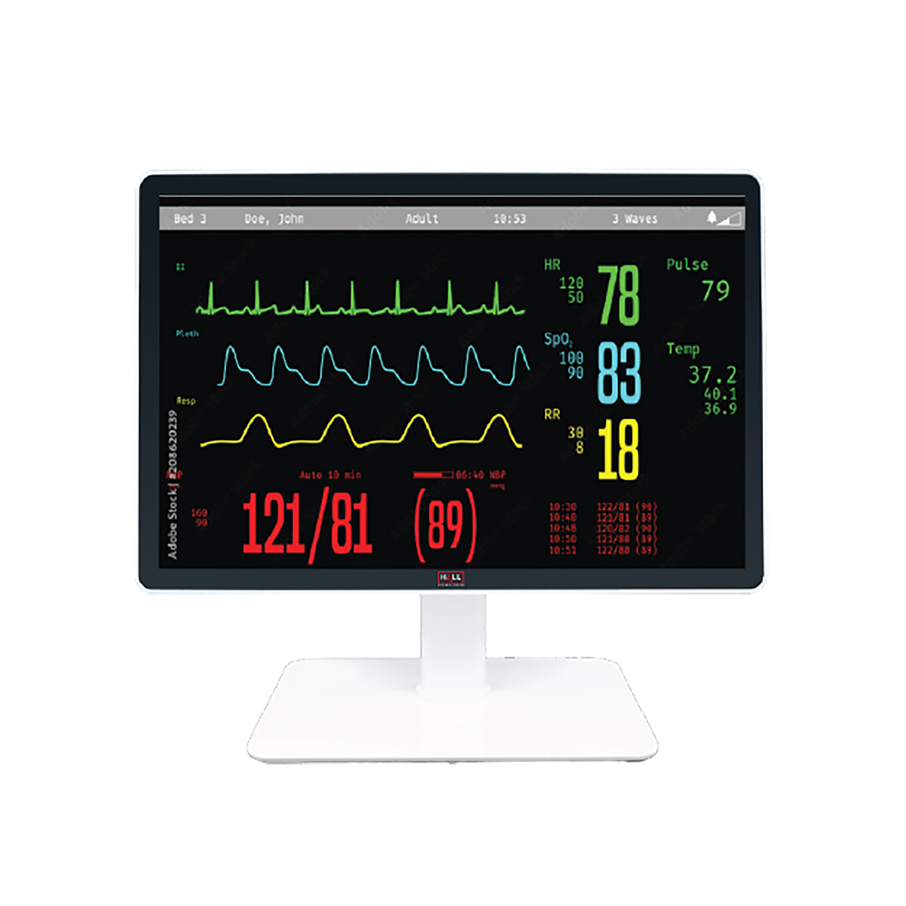 Hall Vision HT-HVM32 32-Inch HD Medical Monitor for Hospitals ...